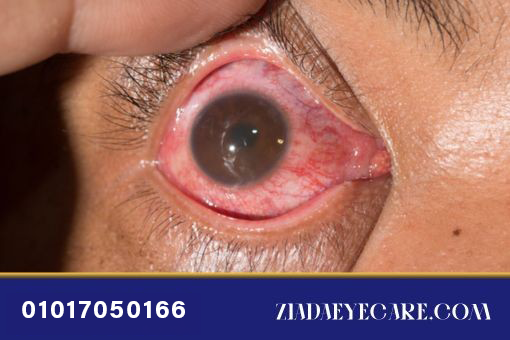 Retina and uveitis image